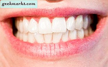 Wie man Zähne in Paint.net aufhellt